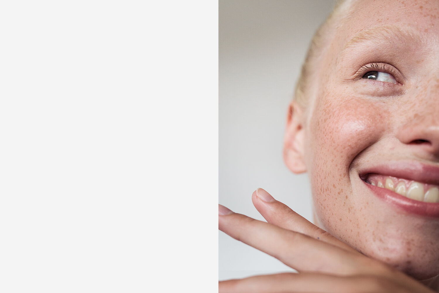 Skin prone to redness